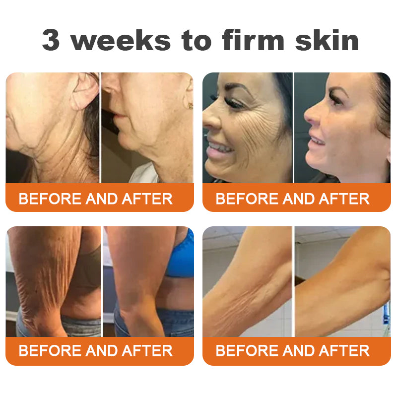🐝🎁Made and Shipped from Australia✨LOVILDS™ Botulinum Toxin Bee Poison Firming Serum Stick🔥LAST DAY 70% OFF