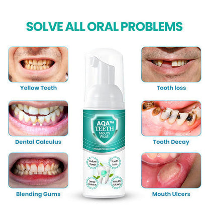 🔥 LAST DAY SALE 70% OFF 🔥AQA™ NEW TEETH Mouthwash - Solve all Oral Problems